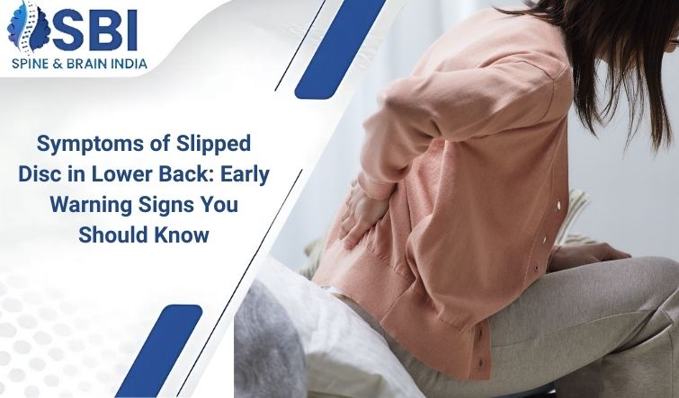 علائم دیسک لغزنده در پایین کمر: علائم هشداردهنده اولیه که باید بدانید